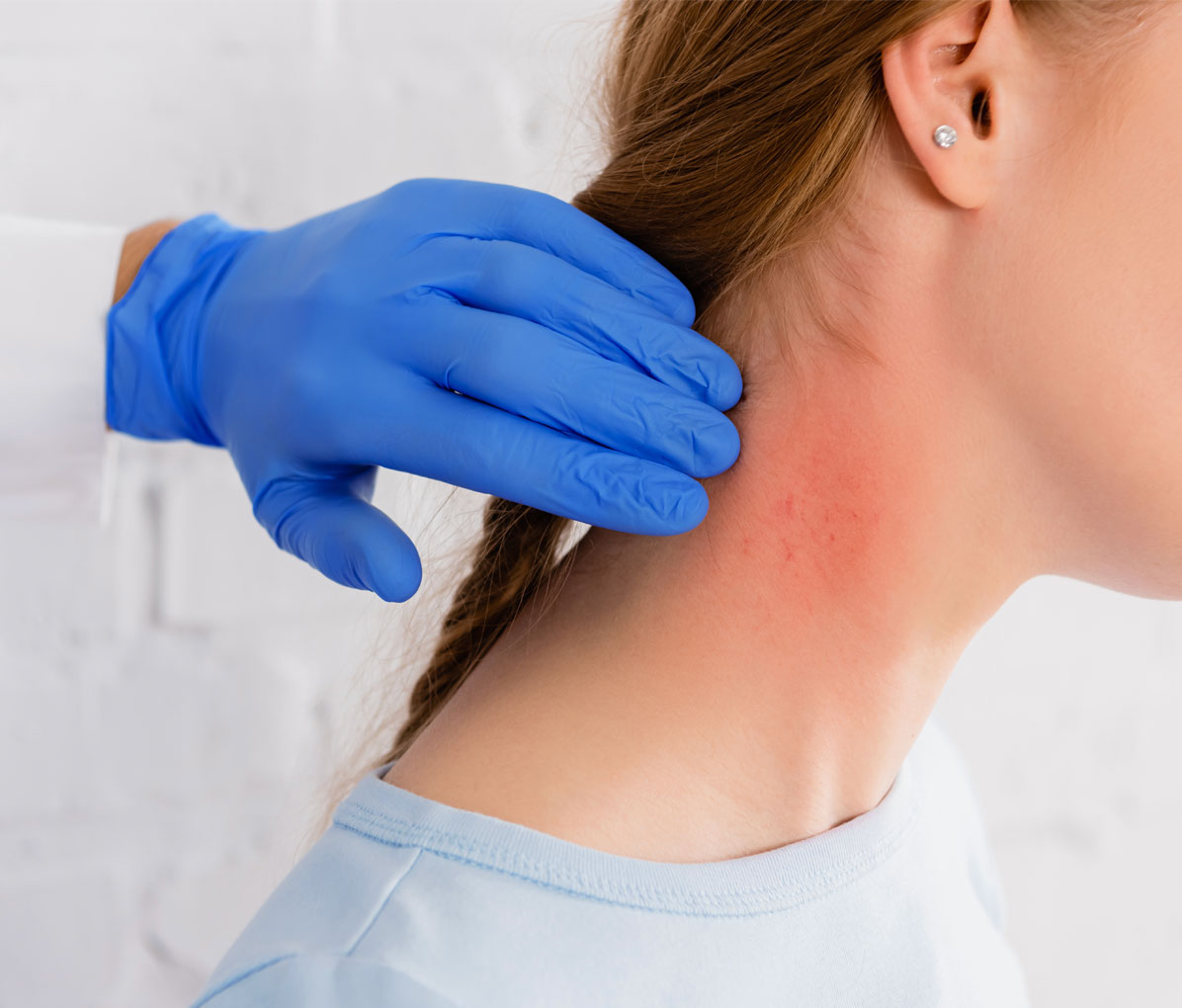 Strategic Dermatology CRO Solutions for Clinical Research and Treatment Development