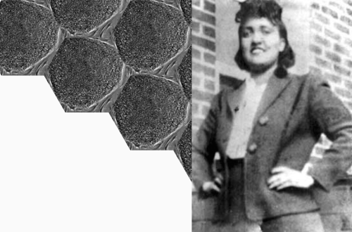Henrietta Lacks and lessons learned about clinical research in the black community