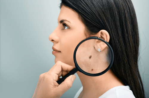 Skin Cancer Awareness Infographic - Facts, Prevention, Survival Rates