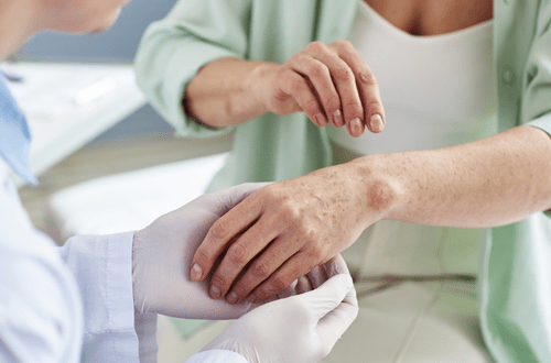 TFS is Your Global CRO Partner in Dermatology