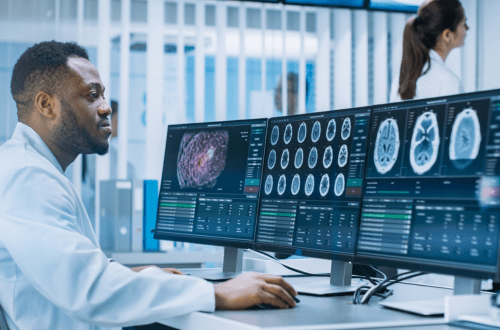 TFS’s Expertise in Neuroscience