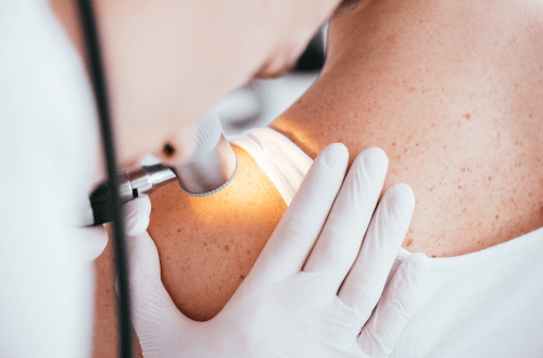 Image to represent Top 5 Advances in Skin Cancer Research in 2024