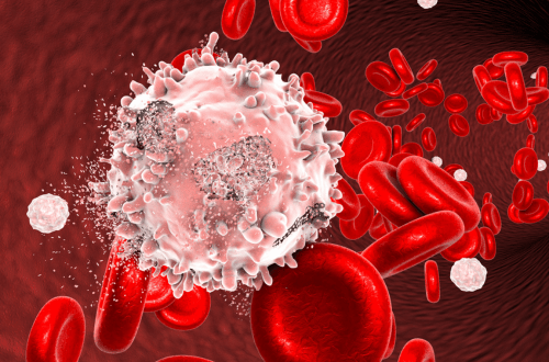 Understanding Different Types of Blood Cancers and Their Treatments